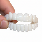 Zahnblenden Set Thermoplastisch Anpassbar Natürliches Weiß